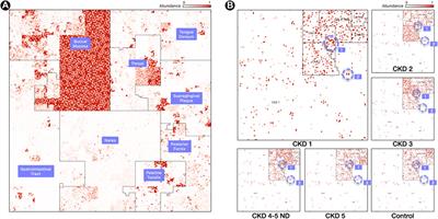 Microbiome maps: Hilbert curve visualizations of metagenomic profiles